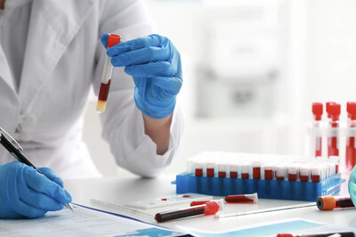 Link to: /pages/comprehensive-labs-blood-work